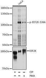 Phospho-EEF2K (Ser366) Antibody in Western Blot (WB)