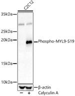 Phospho-MYL9 (Ser19) Antibody in Western Blot (WB)