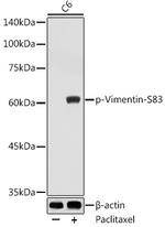 Phospho-Vimentin (Ser83) Antibody in Western Blot (WB)