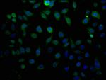 LTC4S Antibody in Immunocytochemistry (ICC/IF)