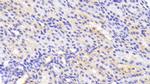 Tankyrase 2 Antibody in Immunohistochemistry (Paraffin) (IHC (P))