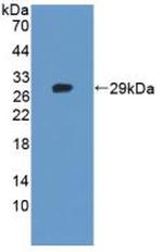 Tankyrase 2 Antibody in Western Blot (WB)