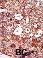 ZMPSTE24 Antibody in Immunohistochemistry (Paraffin) (IHC (P))