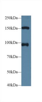 NUP98 Antibody in Western Blot (WB)