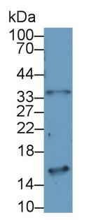 NMB Antibody in Western Blot (WB)