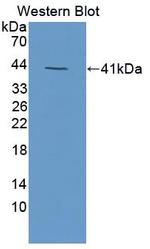 NMB Antibody in Western Blot (WB)