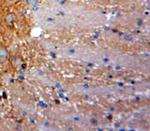 HIN-1 Antibody in Immunohistochemistry (Paraffin) (IHC (P))