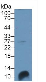 HIN-1 Antibody in Western Blot (WB)