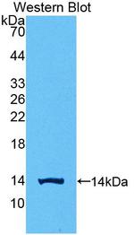 hCG beta-1 Antibody in Western Blot (WB)