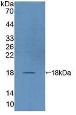 DUSP5 Antibody in Western Blot (WB)
