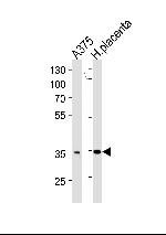 AKR1B1 Antibody in Western Blot (WB)