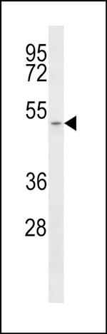 MCT1 Antibody in Western Blot (WB)