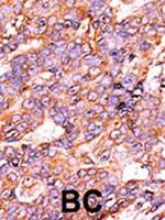 Phospho-Histone H3 (Ser10) Antibody in Immunohistochemistry (Paraffin) (IHC (P))