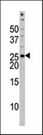 Phospho-BAD (Ser118) Antibody in Western Blot (WB)