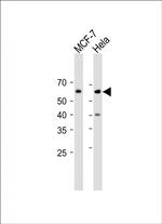 Phospho-Cdc25A (Ser293) Antibody in Western Blot (WB)