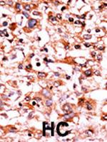 Phospho-CDK1 (Ser39) Antibody in Immunohistochemistry (Paraffin) (IHC (P))