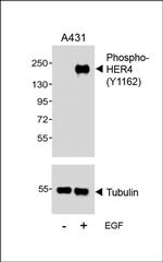 Phospho-ErbB4 (Tyr1162) Antibody in Western Blot (WB)