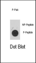 Phospho-MAPKAPK2 (Ser272) Antibody in Dot Blot (DB)