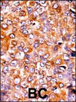 Phospho-PKMYT1 (Thr495) Antibody in Immunohistochemistry (Paraffin) (IHC (P))