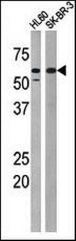 Phospho-PKMYT1 (Thr495) Antibody in Western Blot (WB)