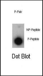 Phospho-p21 (Thr57) Antibody in Dot Blot (DB)