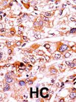 Phospho-p21 (Thr57) Antibody in Immunohistochemistry (Paraffin) (IHC (P))