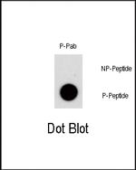 Phospho-NR4A1 (Ser351) Antibody in Dot Blot (DB)