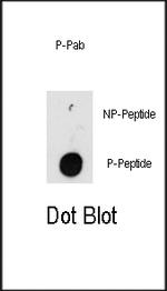 Phospho-ILK (Thr173) Antibody in Dot Blot (DB)