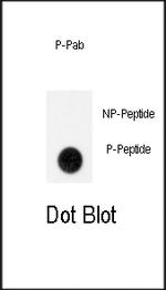 Phospho-GIT1 (Tyr554) Antibody in Dot Blot (DB)