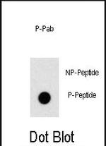 Phospho-PLZF (Tyr334) Antibody in Dot Blot (DB)