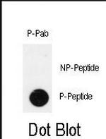 Phospho-PDX1 (Thr11) Antibody in Dot Blot (DB)