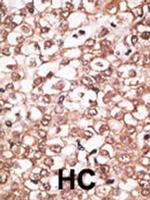 BSEP Antibody in Immunohistochemistry (Paraffin) (IHC (P))