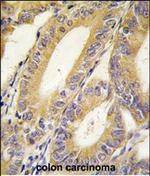 XIAP Antibody in Immunohistochemistry (Paraffin) (IHC (P))