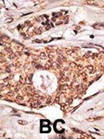 ICOS (CD278) Antibody in Immunohistochemistry (Paraffin) (IHC (P))