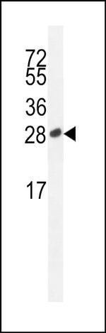 ICOS (CD278) Antibody in Western Blot (WB)