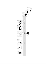 AF9 Antibody in Western Blot (WB)