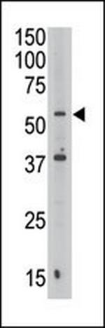 Septin-9 Antibody in Western Blot (WB)