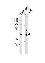 Septin-9 Antibody in Western Blot (WB)