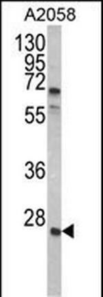 GRB2 Antibody in Western Blot (WB)