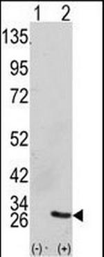 GRB2 Antibody in Western Blot (WB)