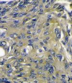 VEGFD Antibody in Immunohistochemistry (Paraffin) (IHC (P))