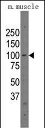 PARP12 Antibody in Western Blot (WB)