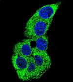 gamma Actin Antibody in Immunocytochemistry (ICC/IF)