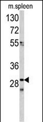 CDCA3 Antibody in Western Blot (WB)