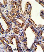 TROP2 Antibody in Immunohistochemistry (Paraffin) (IHC (P))