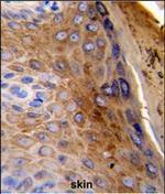 Cytokeratin 10 Antibody in Immunohistochemistry (Paraffin) (IHC (P))