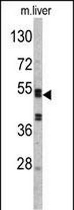 SERPINC1 Antibody in Western Blot (WB)