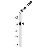 SERPINC1 Antibody in Western Blot (WB)