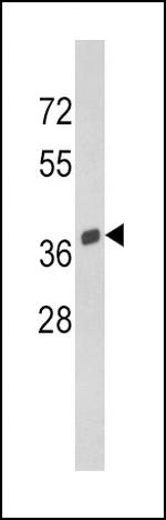 SPARC Antibody in Western Blot (WB)