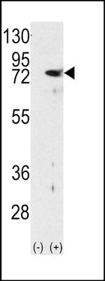 PKC delta Antibody in Western Blot (WB)